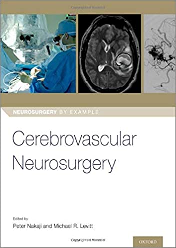 Cerebrovascular Neurosurgery (Neurosurgery by Example) 2019 - نورولوژی
