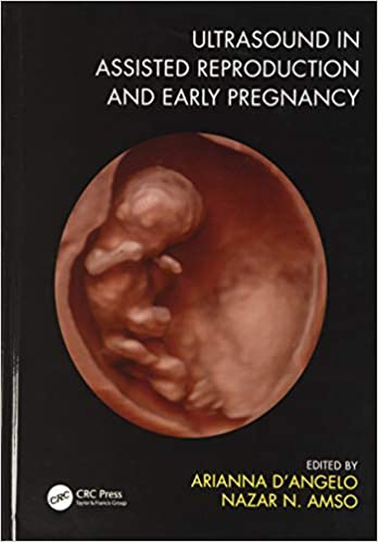 سونوگرافی در تولید مثل کمک کرده و در اوایل بارداری - زنان و مامایی
