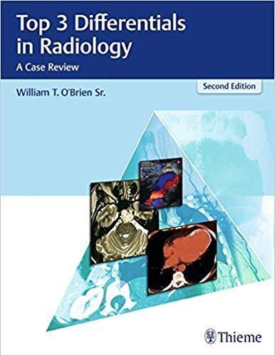 3 مورد برتر در رادیولوژی: بررسی موارد - رادیولوژی