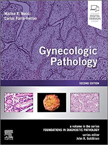 Gynecologic Pathology: A Volume in Foundations in Diagnostic Pathology Series 2021 - پاتولوژی