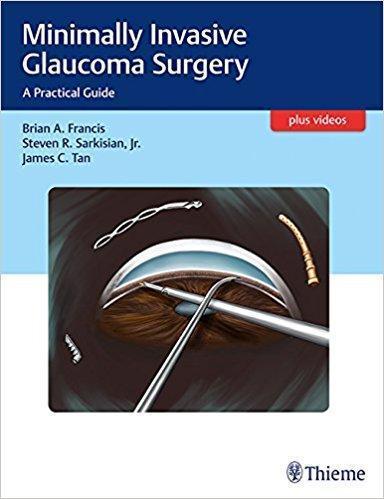 Minimally Invasive Glaucoma Surgery - چشم