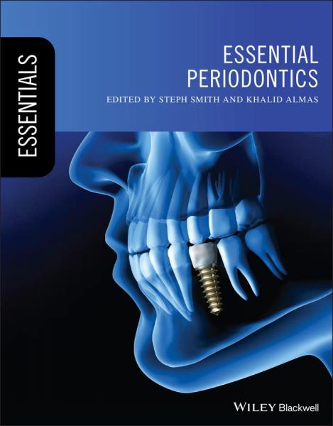 Essential Periodontics (Essentials (Dentistry))(2022) 1st Edition - دندانپزشکی