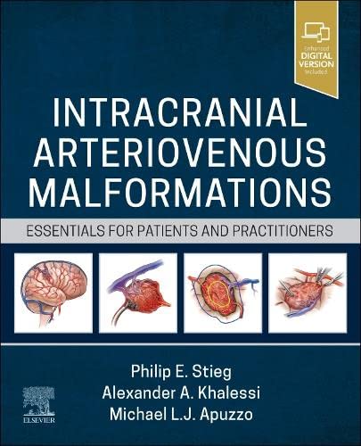 Intracranial Arteriovenous Malformations: Essentials for Patients and Practitioners 2023 - جراحی