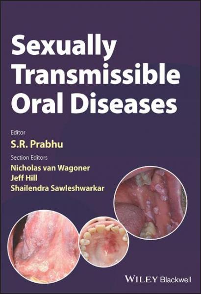 Sexually Transmissible Oral Diseases2023 - دندانپزشکی