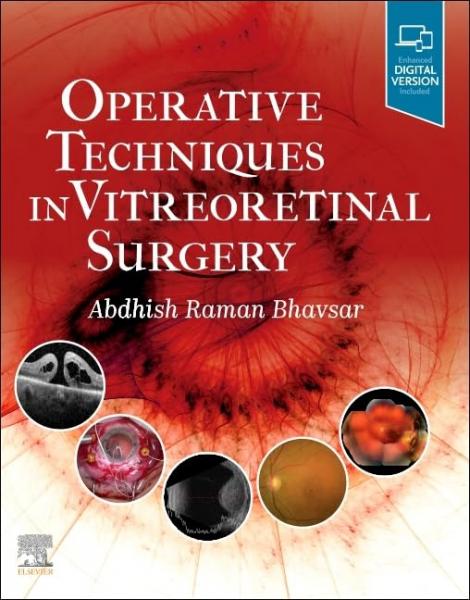 Operative Techniques in Vitreoretinal Surgery 20231st Edition - چشم