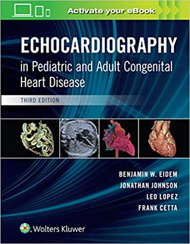 Echocardiography in Pediatric and Adult Congenital Heart Disease  Eidem(tabdili)  2021 - قلب و عروق
