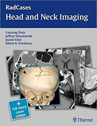 RadCases Head and Neck Imaging  2016 - رادیولوژی