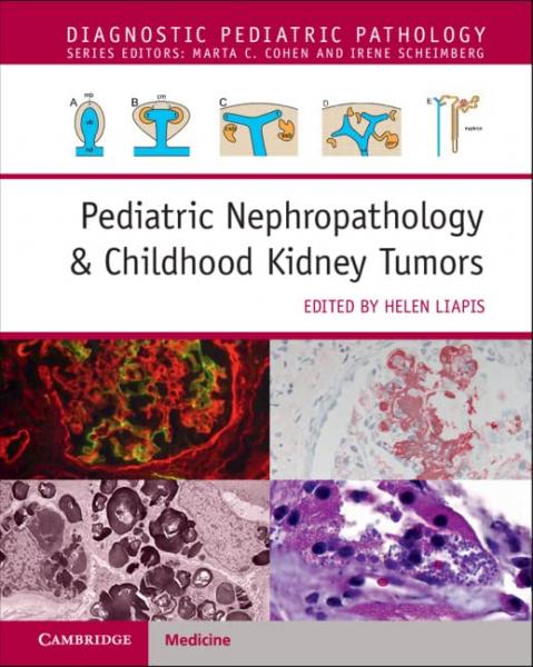 Pediatric Nephropathology & Childhood Kidney Tumors with Online Resource 2023 - اطفال