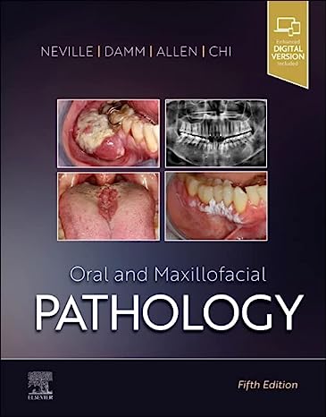 Oral and Maxillofacial Pathology2023 - پاتولوژی