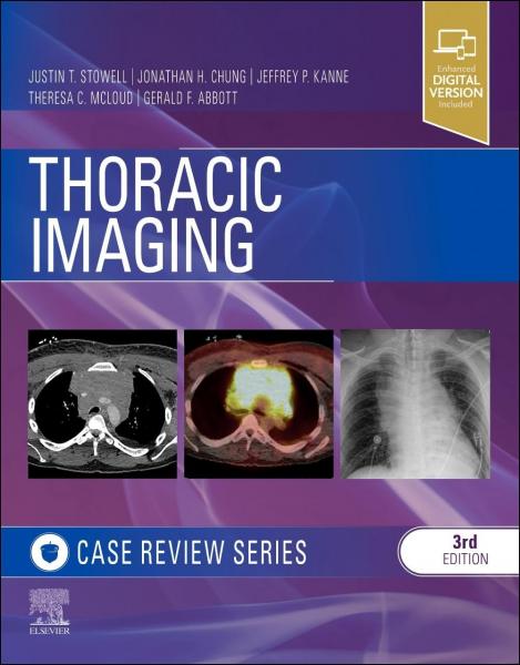 Thoracic Imaging: Case Review(2023) 3rd Edition - رادیولوژی