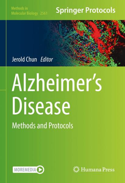 Alzheimer’s Disease  Methods and Protocols 2023 - نورولوژی