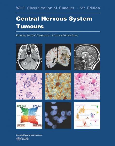 Central Nervous System Tumours: WHO Classification of Tumours 2022 - فرهنگ عمومی و لوازم تحریر