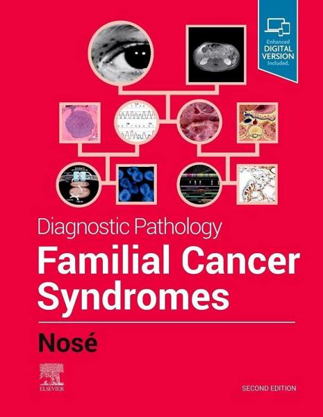 Diagnostic Pathology: Familial Cancer Syndromes2021 - پاتولوژی