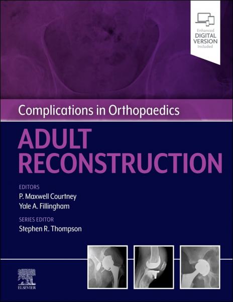 Complications in Orthopaedics: Adult Reconstruction 2022 - اورتوپدی