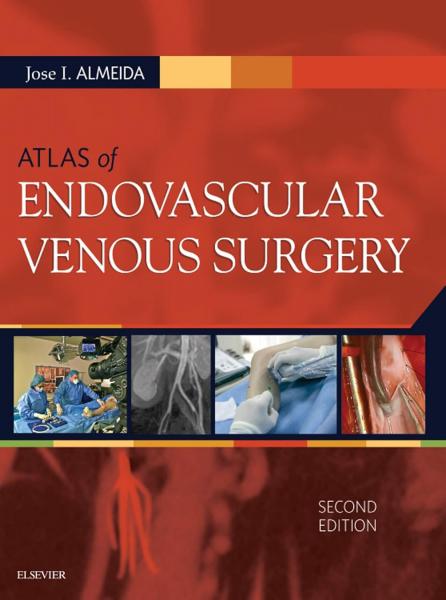 Atlas of Endovascular Venous Surgery2019 - جراحی