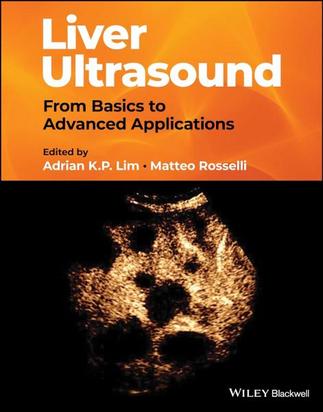 Liver Ultrasound: From Basics to Advanced Applications(2024) 1st Edition - رادیولوژی