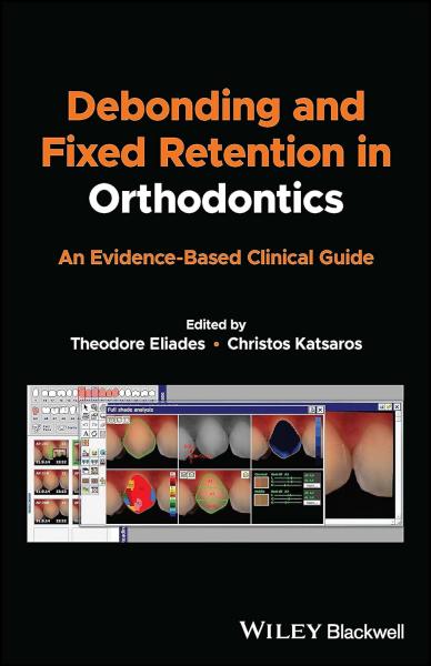 Debonding and Fixed Retention in Orthodontics: An Evidence-Based Clinical Guide2023 - دندانپزشکی