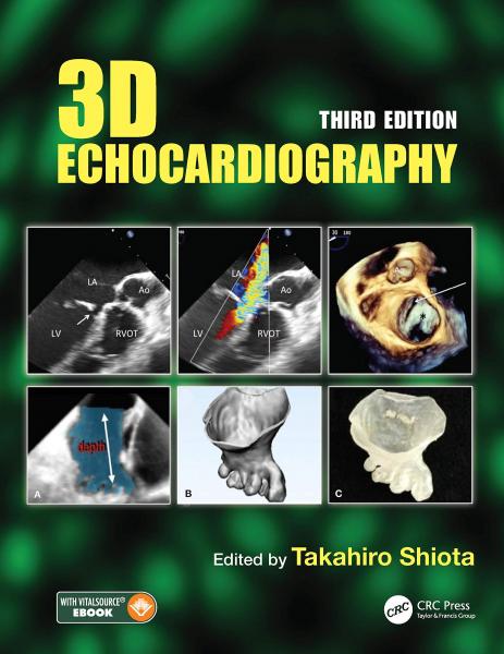 3D Echocardiography(2021) 3rd Edition - قلب و عروق