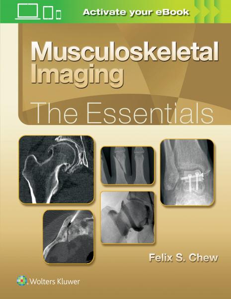 Musculoskeletal Imaging: The Essentials (Essentials Series) First Edition2019 - رادیولوژی