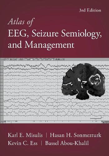 اطلس EEG، نشانه شناسی تشنج، و مدیریت - نورولوژی
