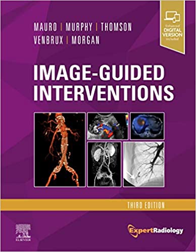 Image-Guided Interventions: Expert Radiology Series+Video  2021 - رادیولوژی
