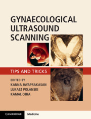 Gynaecological Ultrasound Scanning 2020 - رادیولوژی