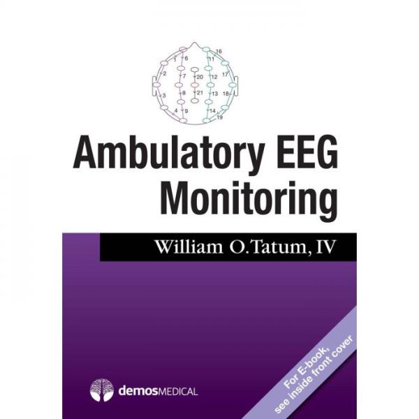 Ambulatory EEG monitoring 2017 - نورولوژی