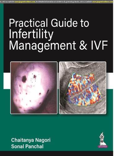 Practical Guide to Infertility Management and IVF2021 - رادیولوژی