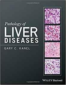 Pathology of Liver Diseases  2017 - پاتولوژی