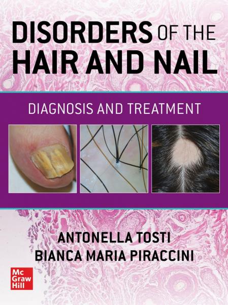 Disorders of the Hair and Nail: Diagnosis and Treatment(2023) 1st Edition - پوست، مو، زیبایی