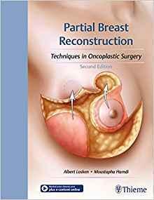 Partial Breast Reconstruction: Techniques in Oncoplastic Surgery 2017 - نورولوژی