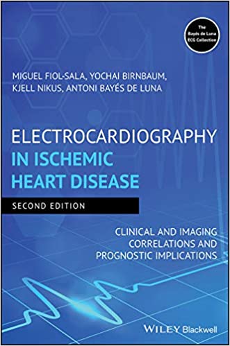 Electrocardiography in Ischemic Heart Disease: Clinical and Imaging Correlations and Prognostic Implications 2020 - قلب و عروق
