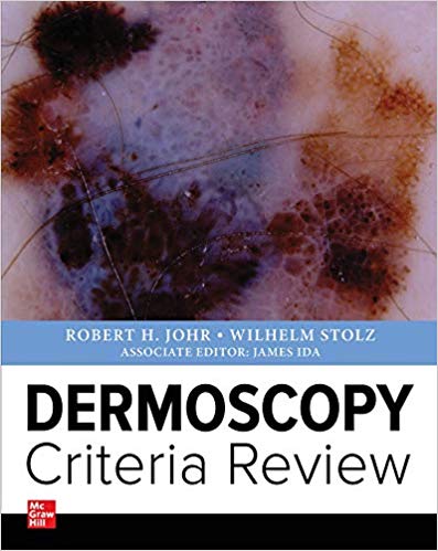  Dermoscopy Criteria Review 2020 - پوست