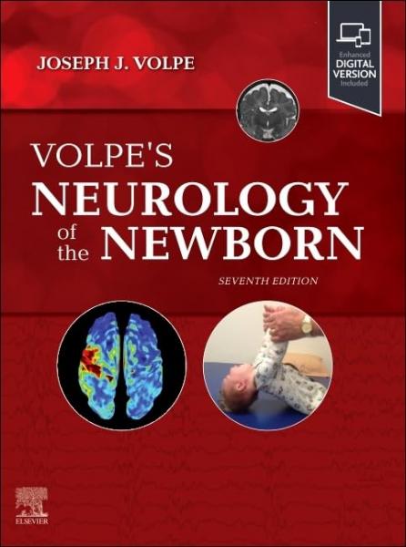ولپ نورولوژی نوزادان - نورولوژی