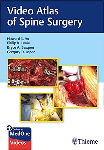 Video Atlas of Spine Surgery 2020 - اورتوپدی