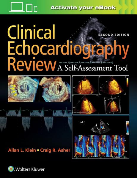 Clinical Echocardiography Review 2017 - قلب و عروق