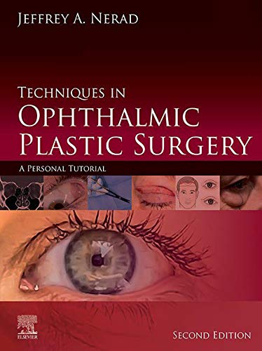 Techniques in Ophthalmic Plastic Surgery: A Personal Tutorial+video 2021 - چشم
